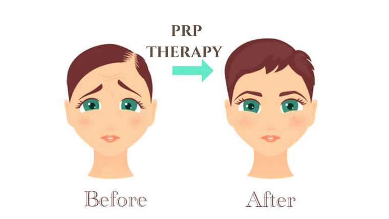 Frequently Asked Questions about PRP Therapy