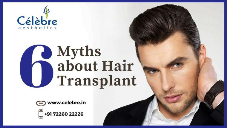 6 Myths about Hair Transplant