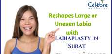 Reshape Large or Uneven Labia with Labiaplasty in Surat