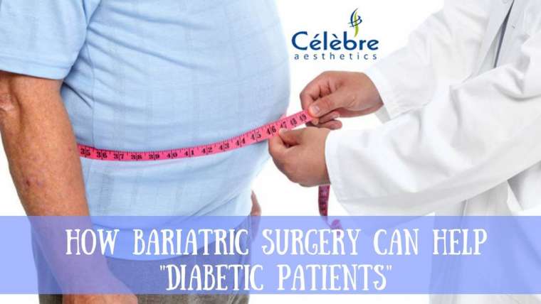 How Bariatric Surgery in Surat Can Help Diabetic Patients